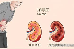 欧洲前七联赛射手榜：凯恩18球居首，姆巴佩第5、哈兰德第6